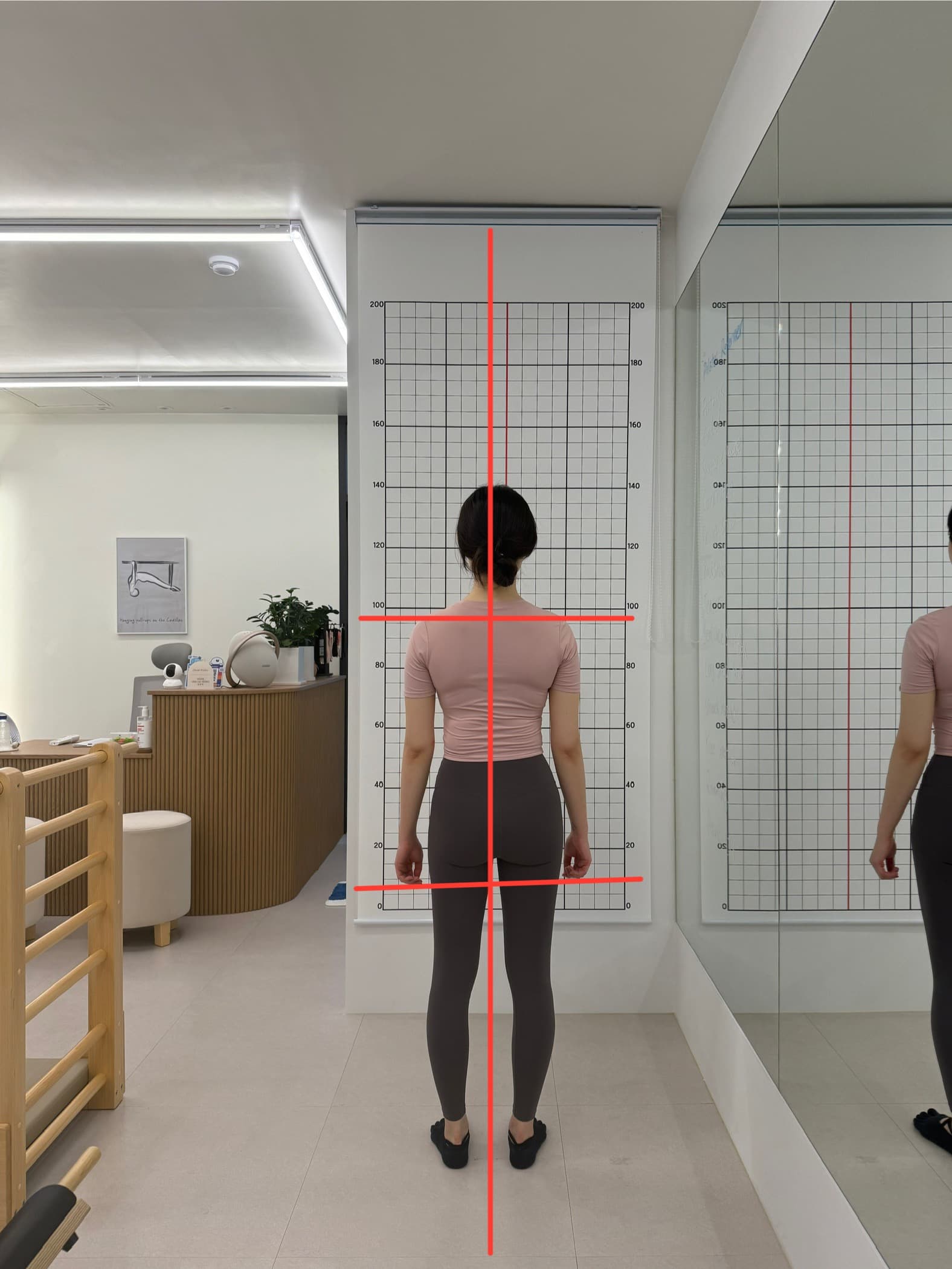 채도필라테스_50대_여성_비포_어깨